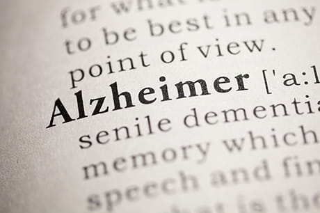 alzheimer