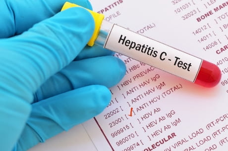 Vile used for hepatitis c test