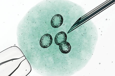 A photographic representation of egg retrieval as part of the in vitro fertilization (IVF) process.