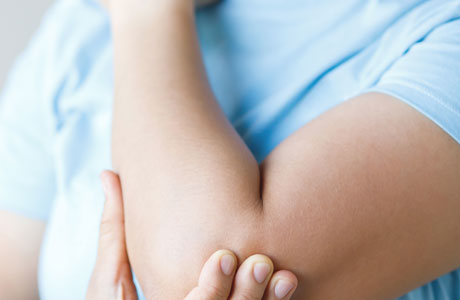 Are those bumps on your arms keratosis pilaris?