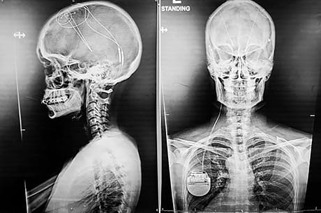 Scans of a patient's chest and head area.